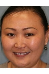 Konig Center for Cosmetic & Comprehensive Dentistry smile photos